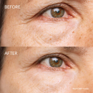 Iren Shizen Skin Reboot Antioxidáns szérum arcra és szemkörnyékre előtte-utána hatás